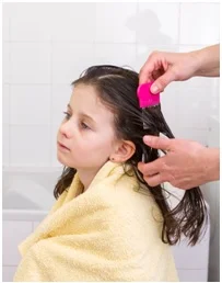 As lêndeas devem ser retiradas com o auxílio de um pente fino