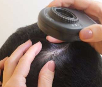 Avaliação das doenças dos cabelos e couro cabeludo através de exame de dermatoscopia