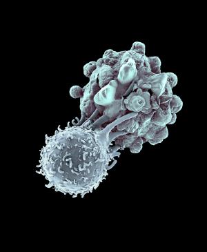 Tratamento do Melanoma: célula do sistema de defesaatacaumacélulacancerígena. 