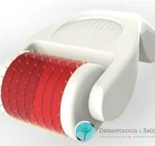 O microagulhamento pode ser feito utilizando-se vários tipos de dispositivos com agulhas que variam de 0,5 a 2,5 mm de comprimento.