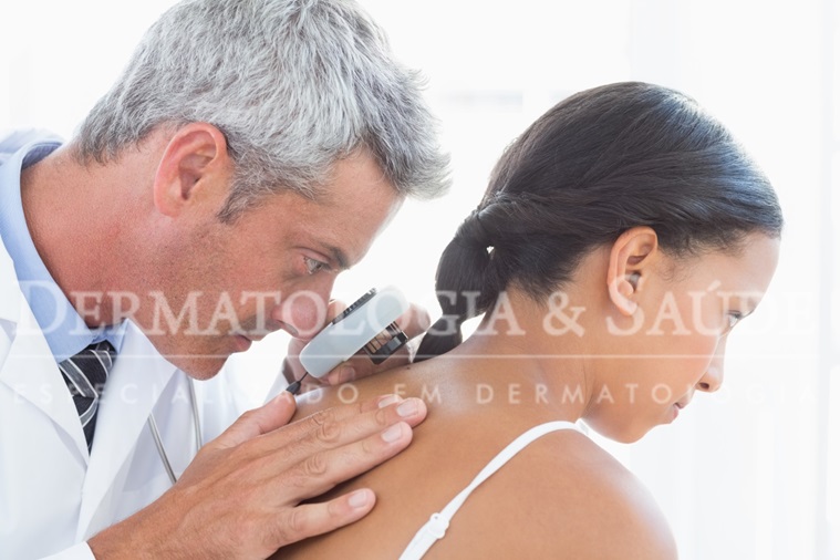 A importância do exame dermatológico na prevenção do câncer de pele