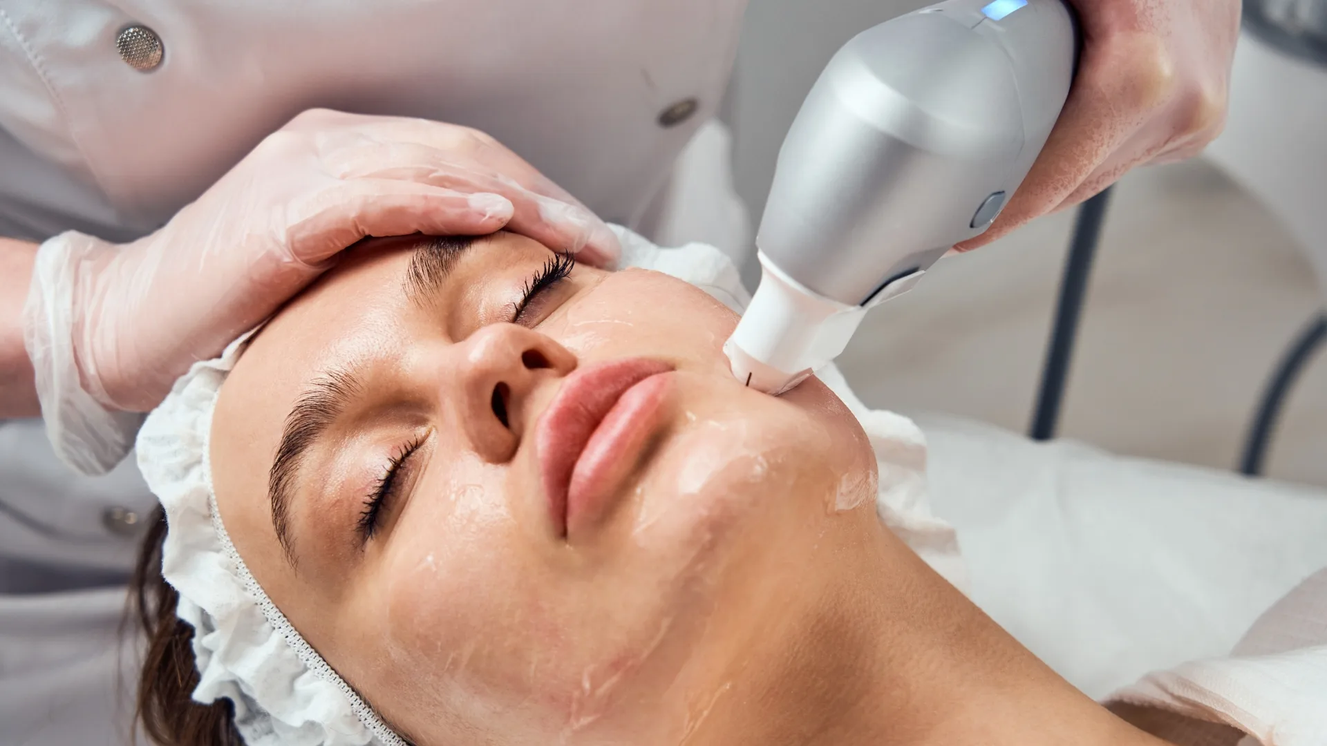 procedimento Ultraformer MPT para tratamento de flacidez facial em consultório dermatológico