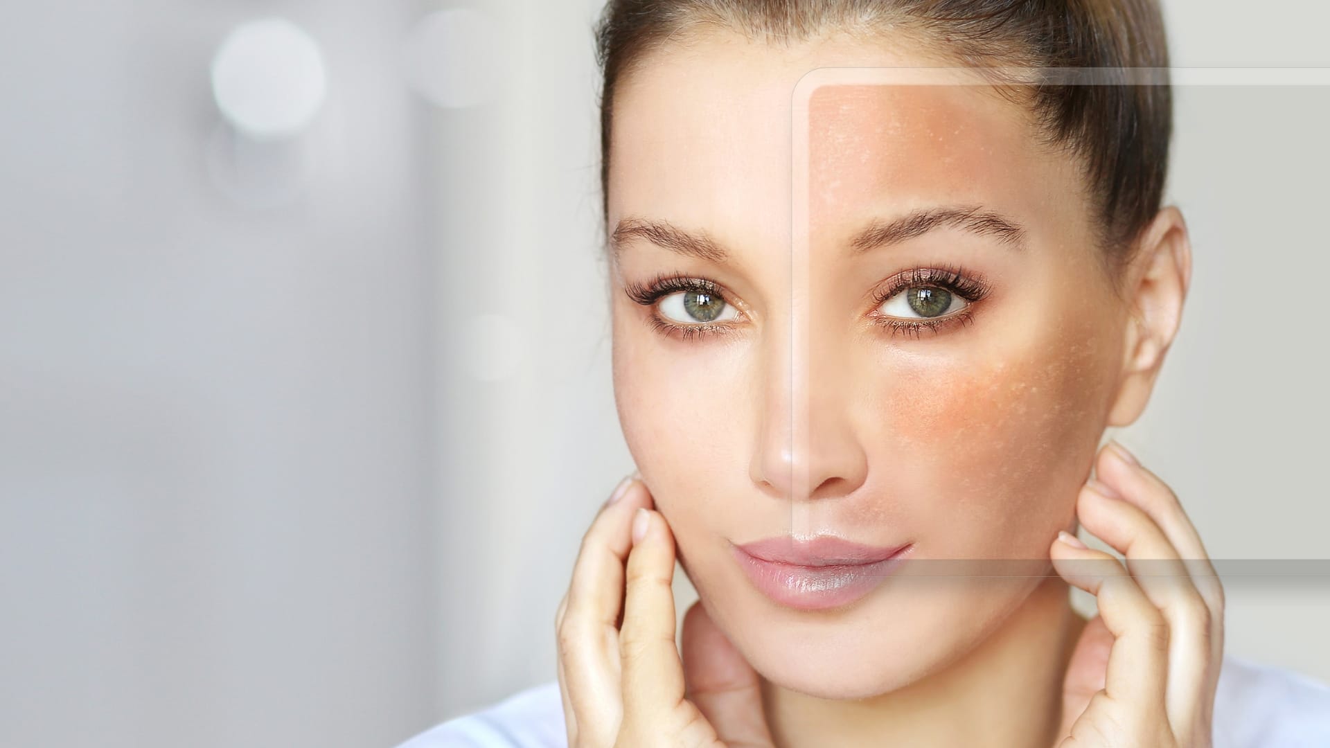 Mulher aplicando protetor solar durante rotina de cuidados para evitar o retorno do melasma.
