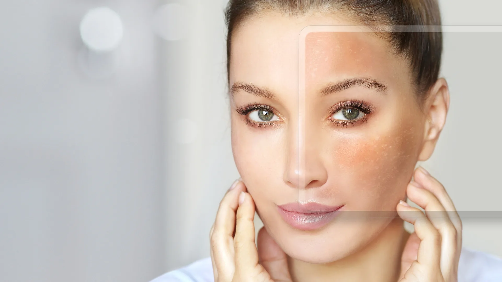 Mulher aplicando protetor solar durante rotina de cuidados para evitar o retorno do melasma.
