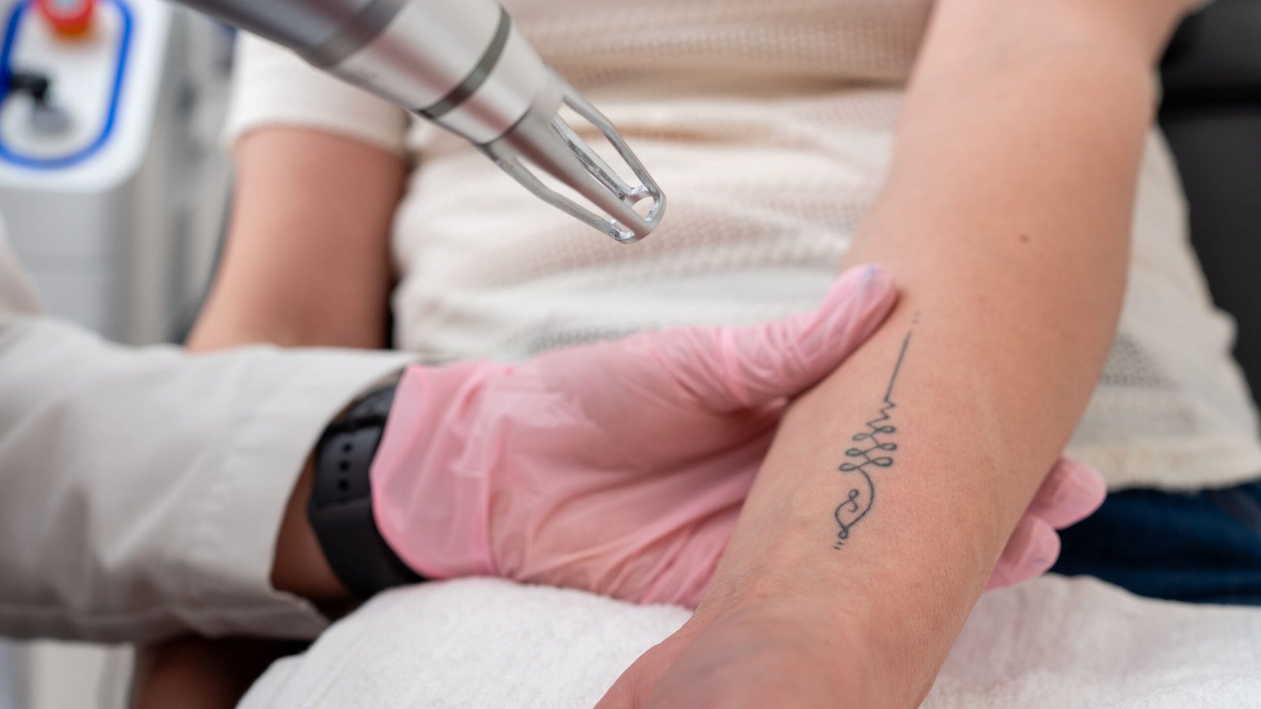 remoção de tatuagem a laser e cuidados para preservar a pele